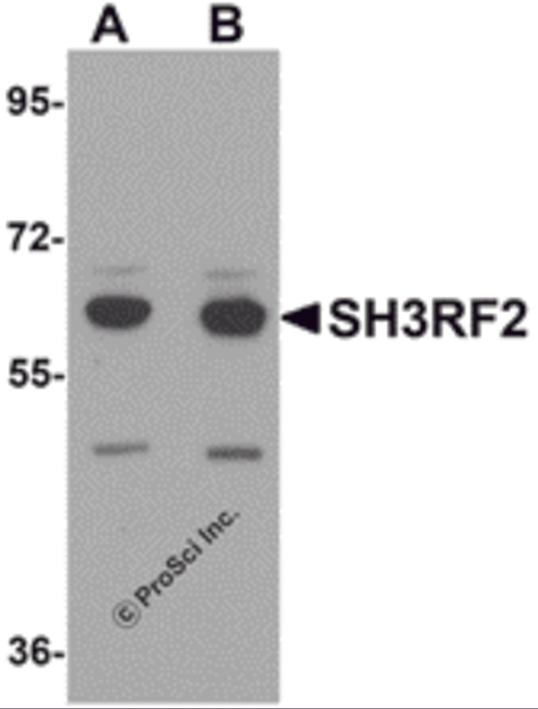 Western blot analysis of SH3RF2 in 3T3 cell lysate with SH3RF2 antibody at (A) 1 and (B) 2 μg/mL.