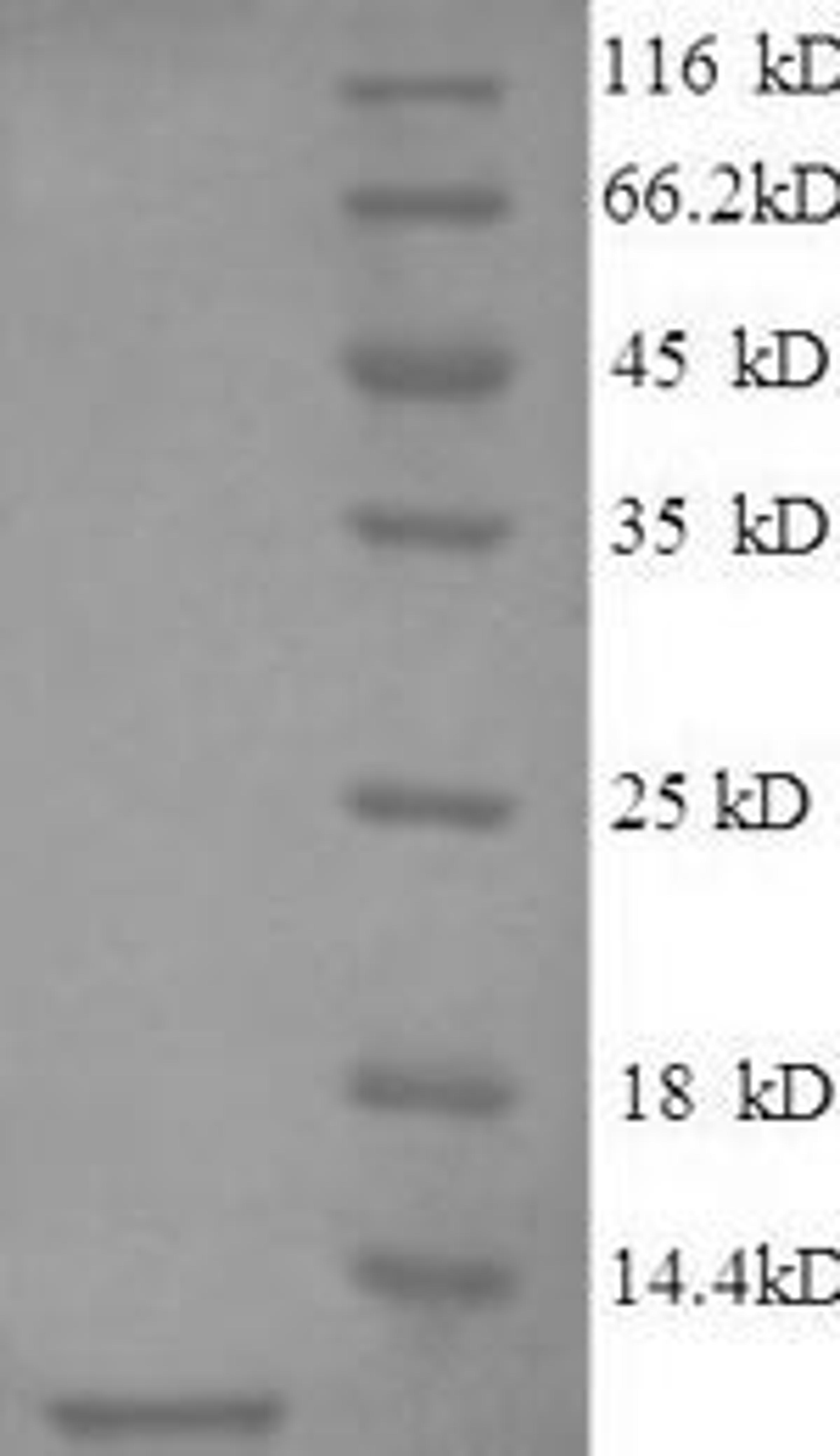 (Tris-Glycine gel) Discontinuous SDS-PAGE (reduced) with 5% enrichment gel and 15% separation gel.