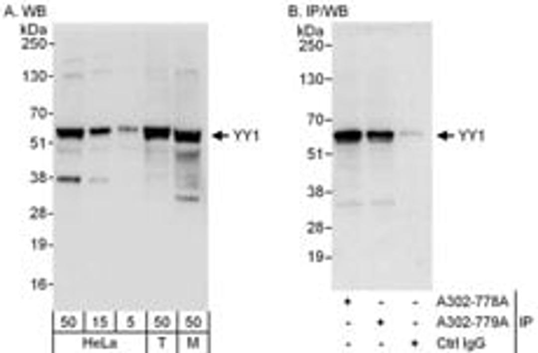 Detection of human and mouse YY1 by western blot (h&m) and immunoprecipitation (h).