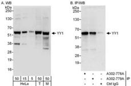 Detection of human and mouse YY1 by western blot (h&m) and immunoprecipitation (h).