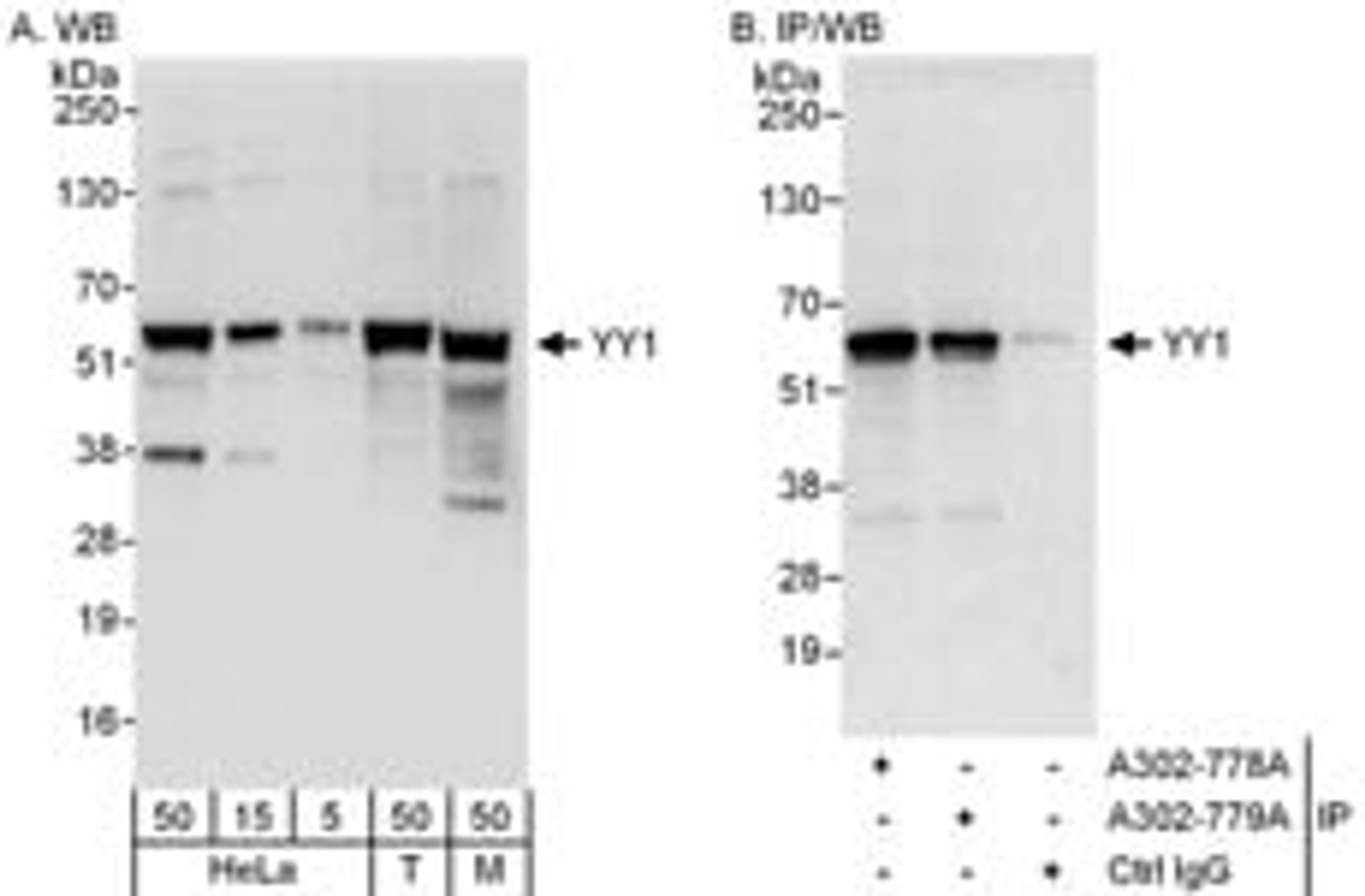 Detection of human and mouse YY1 by western blot (h&m) and immunoprecipitation (h).