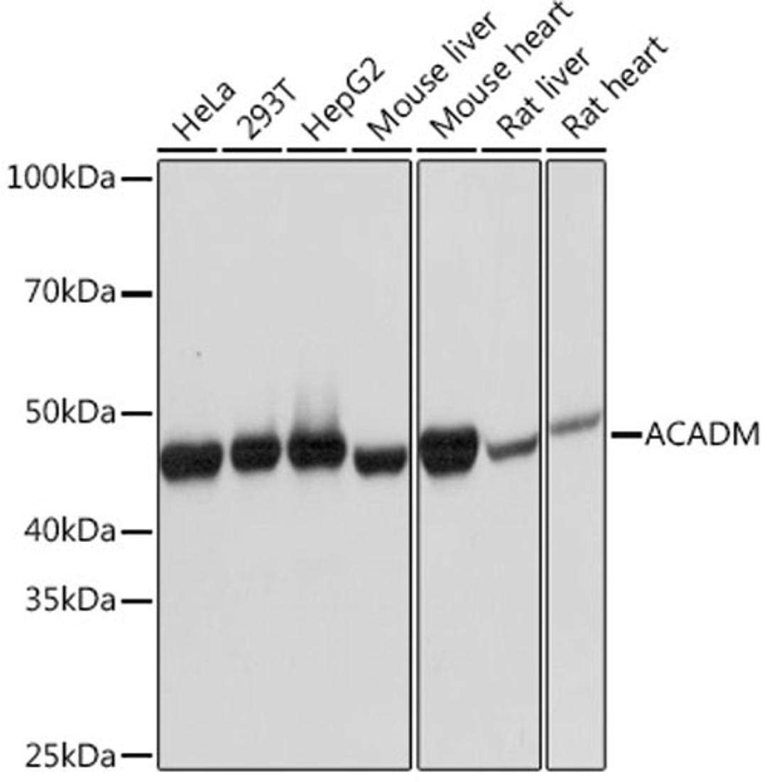 Western blot - ACADM Rabbit mAb (A4567)