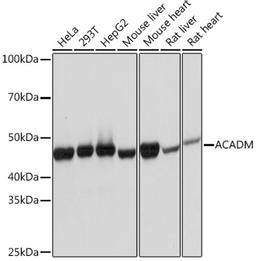 Western blot - ACADM Rabbit mAb (A4567)