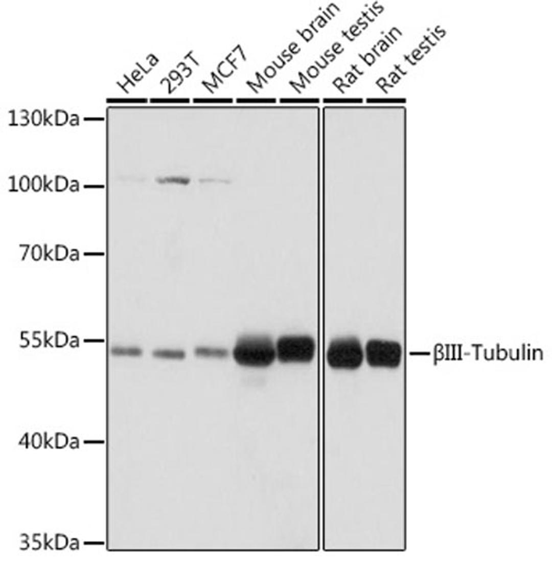 Western blot - ßIII-Tubulin antibody (A17074)