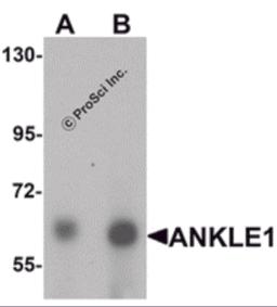 Western blot analysis of ANKLE1 in 293 cell lysate with ANKLE1 antibody at (A) 1 and (B) 2 &#956;g/mL.