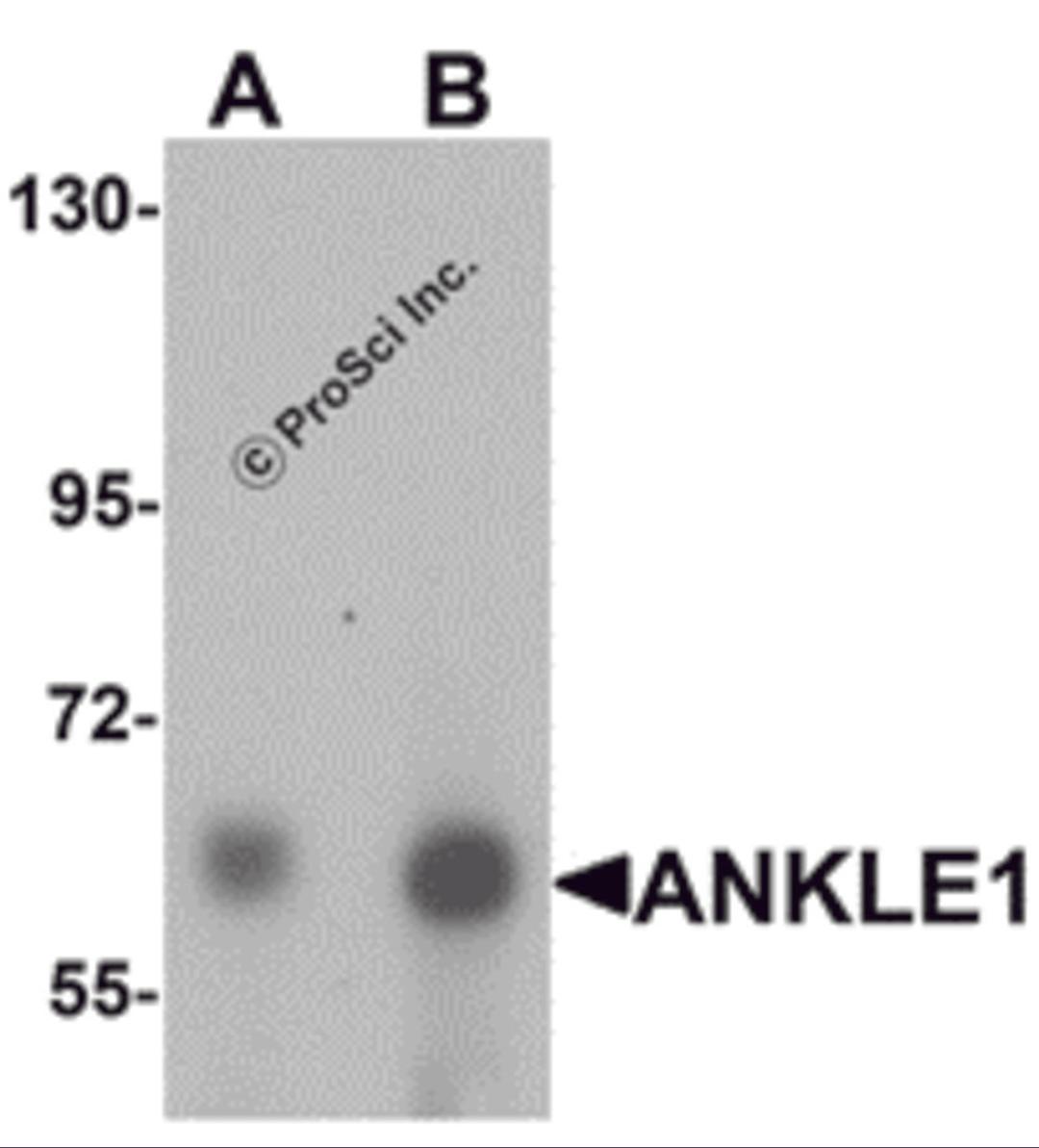 Western blot analysis of ANKLE1 in 293 cell lysate with ANKLE1 antibody at (A) 1 and (B) 2 μg/mL.