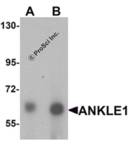 Western blot analysis of ANKLE1 in 293 cell lysate with ANKLE1 antibody at (A) 1 and (B) 2 μg/mL.