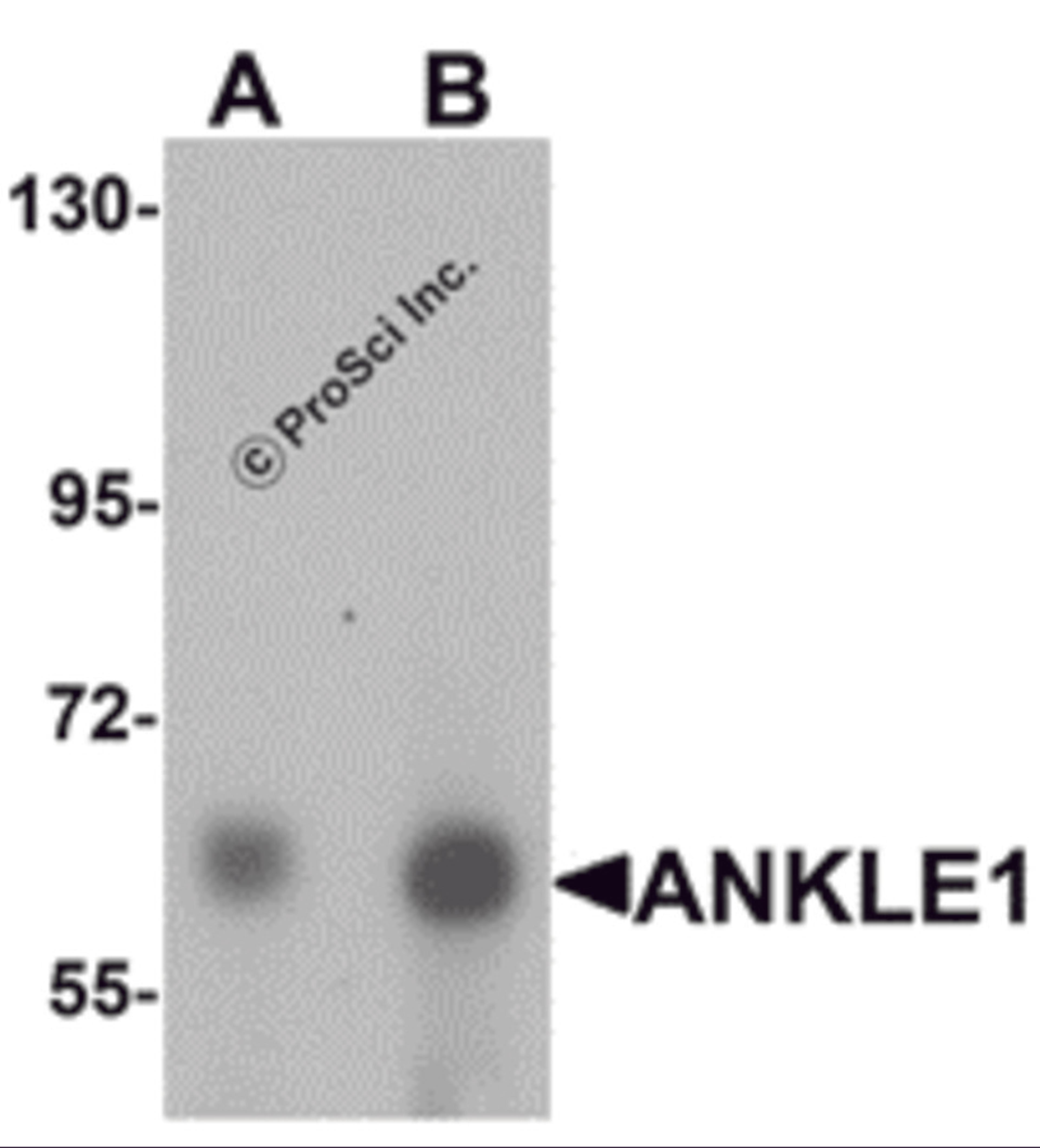 Western blot analysis of ANKLE1 in 293 cell lysate with ANKLE1 antibody at (A) 1 and (B) 2 μg/mL.
