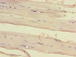 Immunohistochemistry of paraffin-embedded human skeletal muscle tissue using CSB-PA812889LA01HU at dilution of 1:100