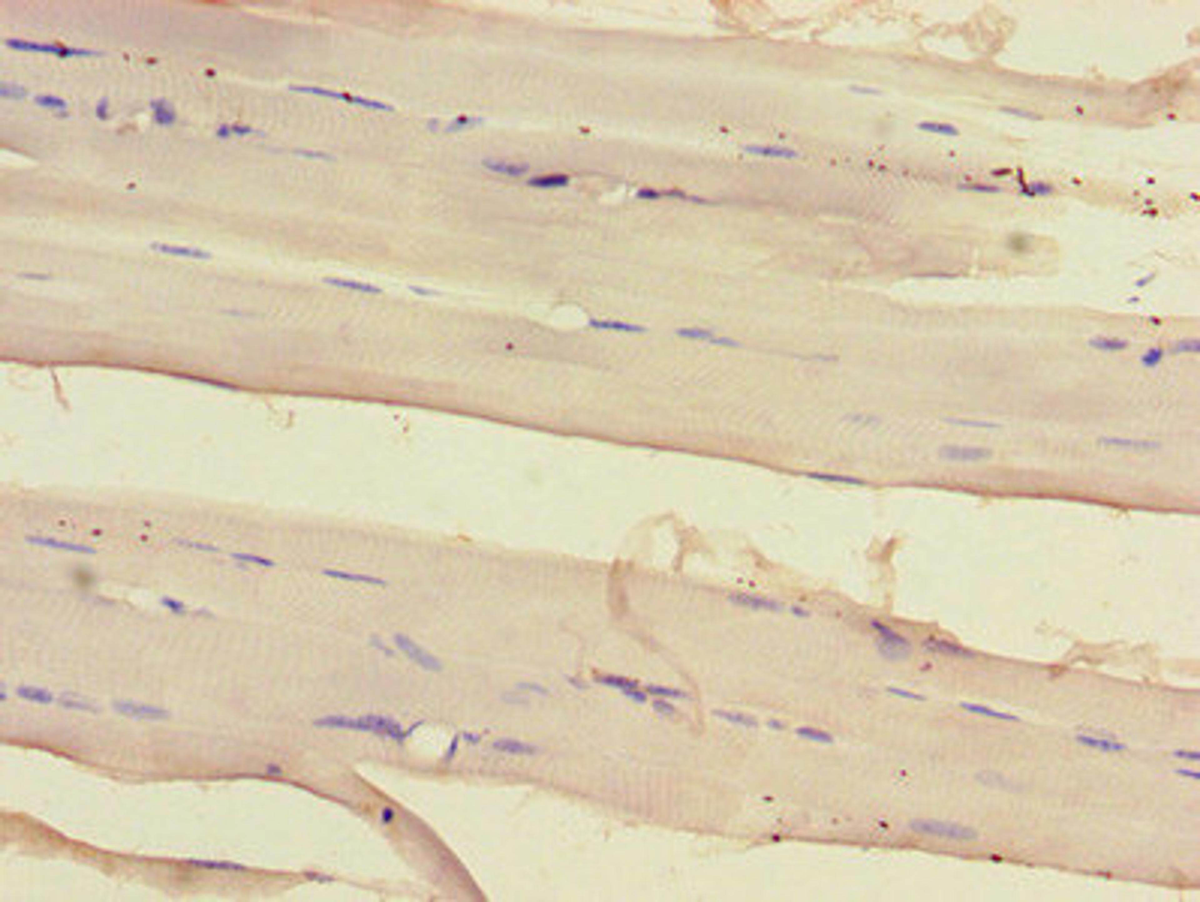 Immunohistochemistry of paraffin-embedded human skeletal muscle tissue using CSB-PA812889LA01HU at dilution of 1:100