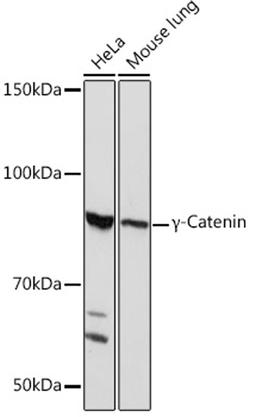 Western blot - ?-Catenin Rabbit mAb (A4157)