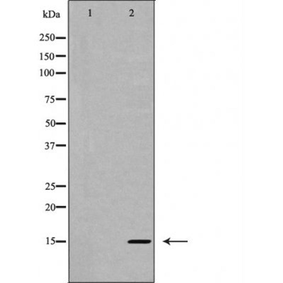 Western blot analysis of HT-29 cells using Interleukin 5 antibody