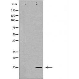 Western blot analysis of HT-29 cells using Interleukin 5 antibody