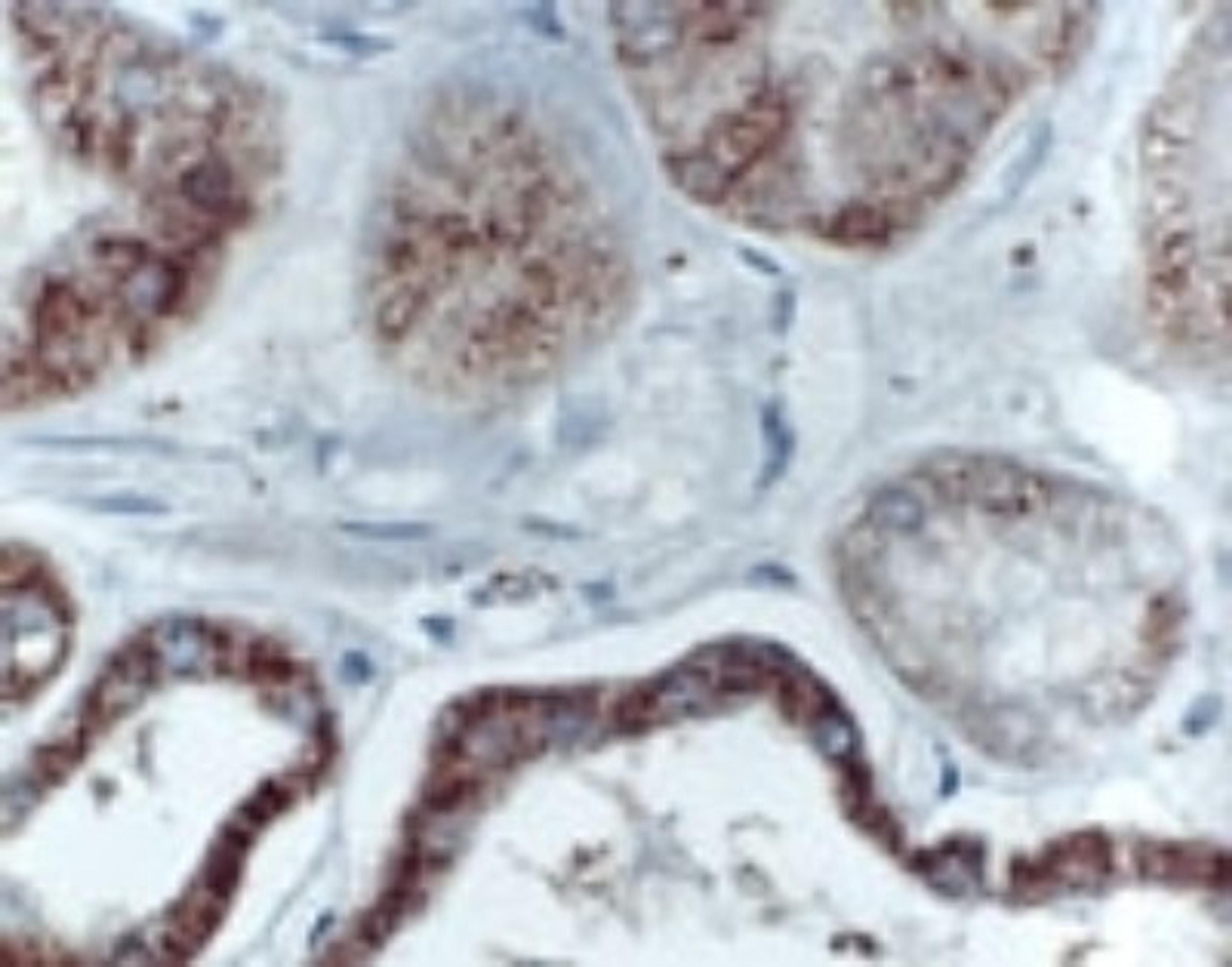 Immunohistochemistry-Paraffin: Bik Antibody [NB100-56109] - Formalin-fixed, paraffin-embedded tissue section of human kidney stained for Bik expression using this antibody at 1:2000. A high level of Bik signal was seen in the distal collecting tubules, the glomeruli are primarily negative.  Hematoxylin-eosin counterstain.