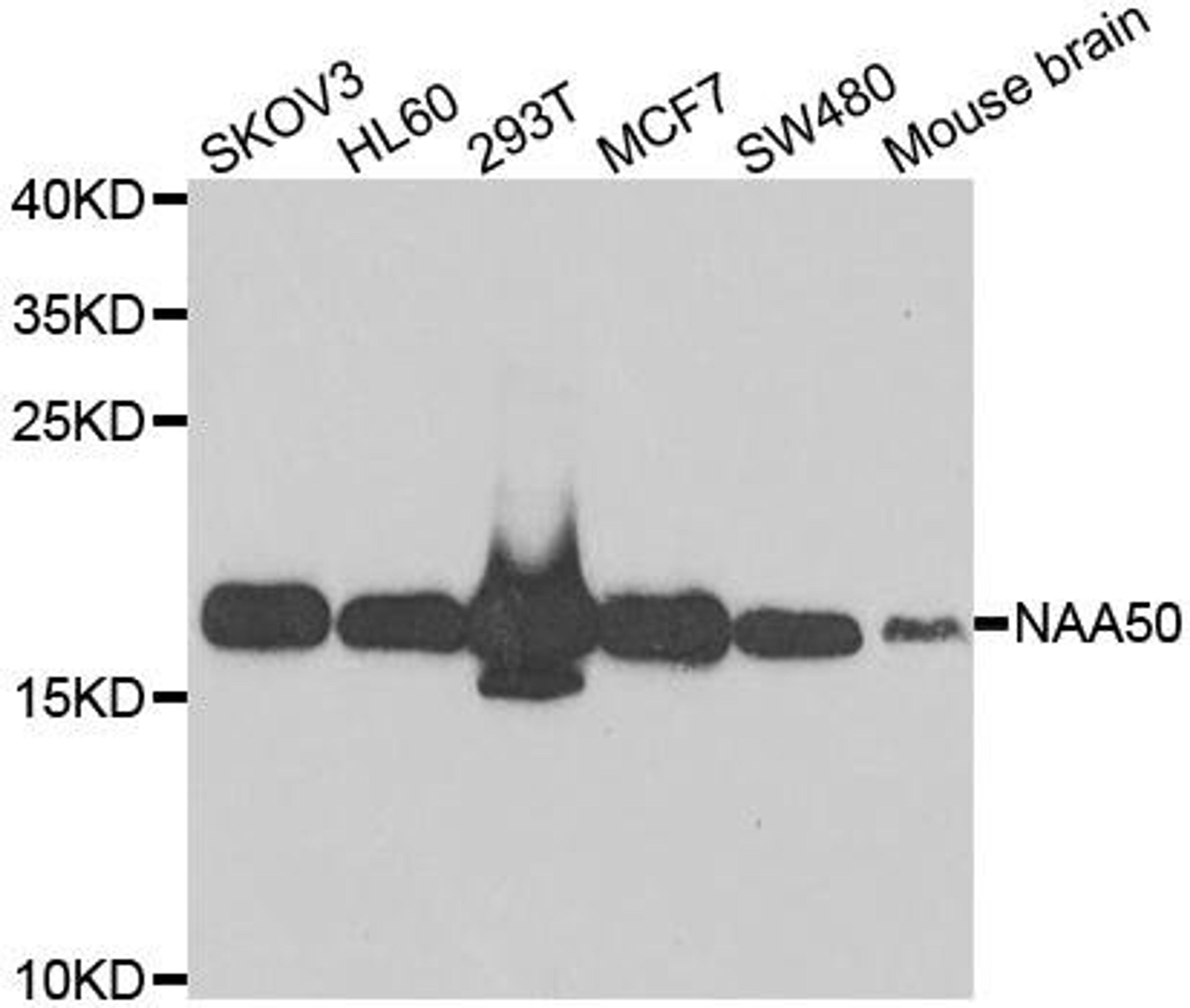 Western blot analysis of extracts of various cell lines using NAA50 antibody