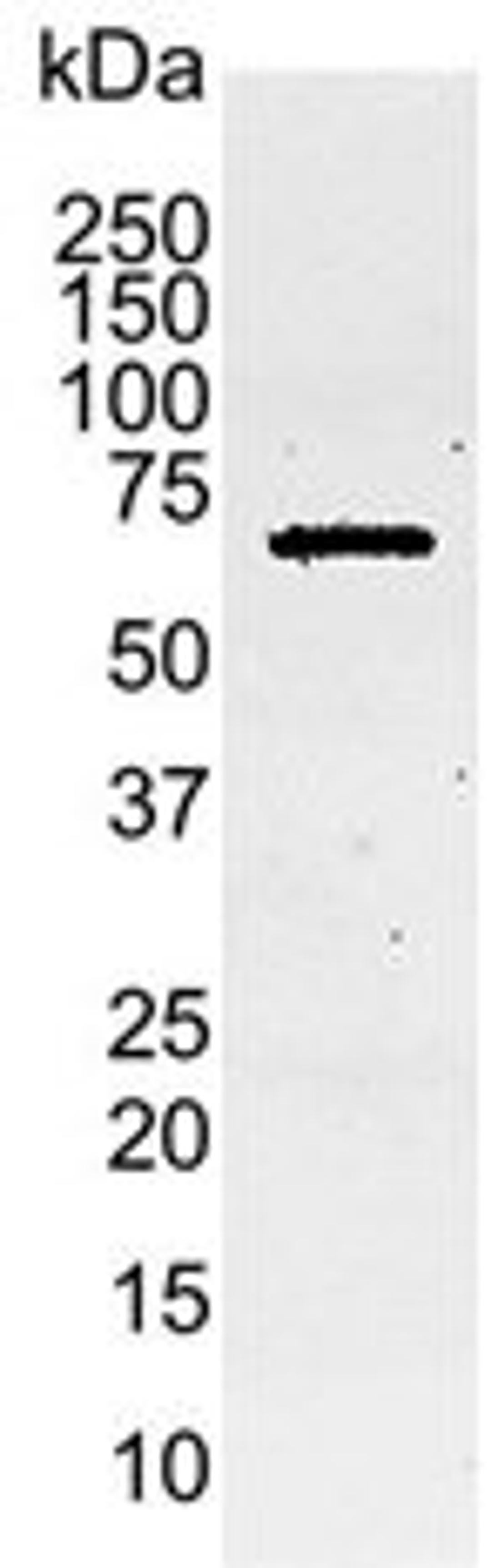 Western blot analysis of C6 rat glioma whole cell lysate