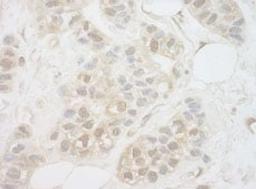 Detection of human UCKL1 by immunohistochemistry.