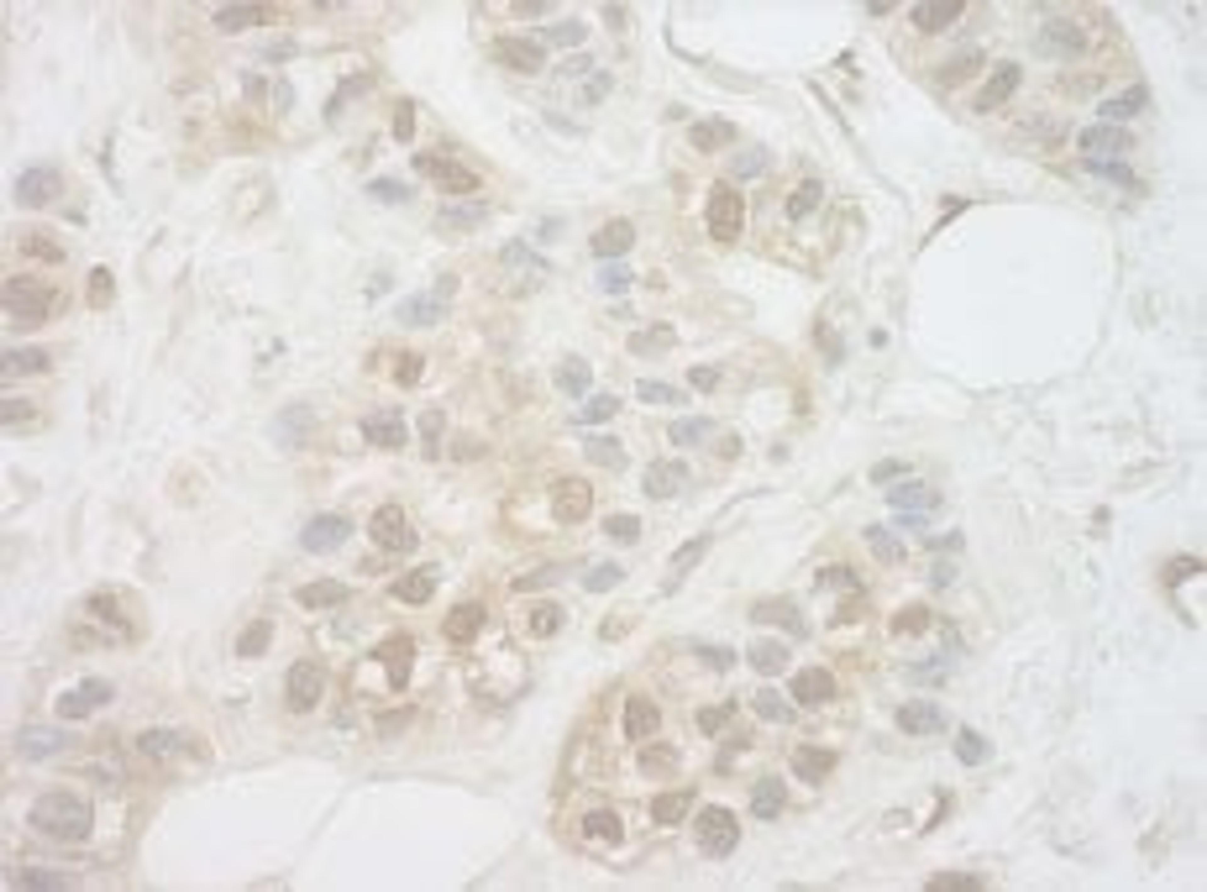 Detection of human UCKL1 by immunohistochemistry.