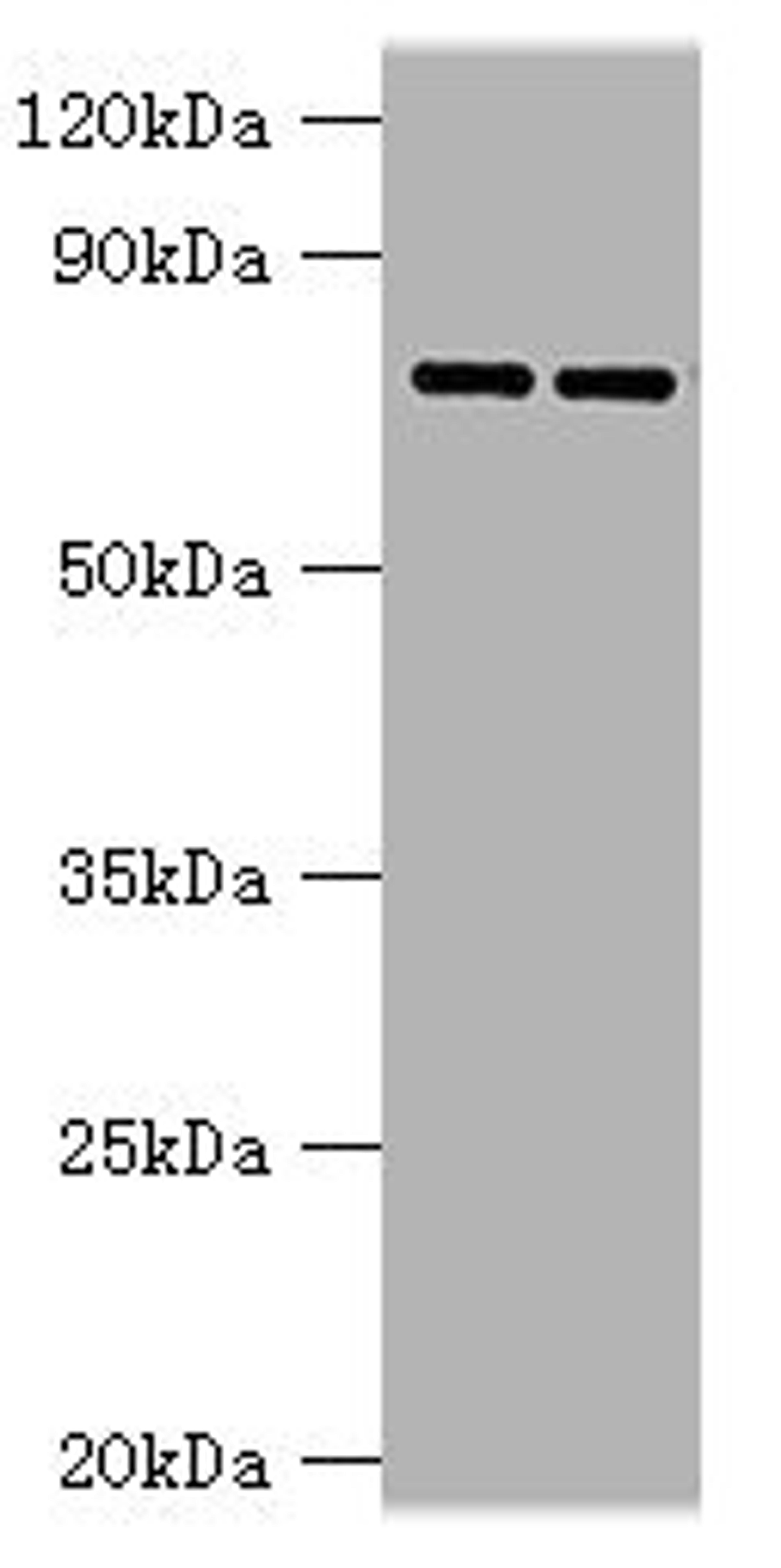 Western blot. All lanes: AGUSB antibody at 2ug/ml. Lane 1: HL60 whole cell lysate. Lane 2: HepG2 whole cell lysate. Secondary. Goat polyclonal to rabbit IgG at 1/10000 dilution. Predicted band size: 75, 70, 59 kDa. Observed band size: 75 kDa.
