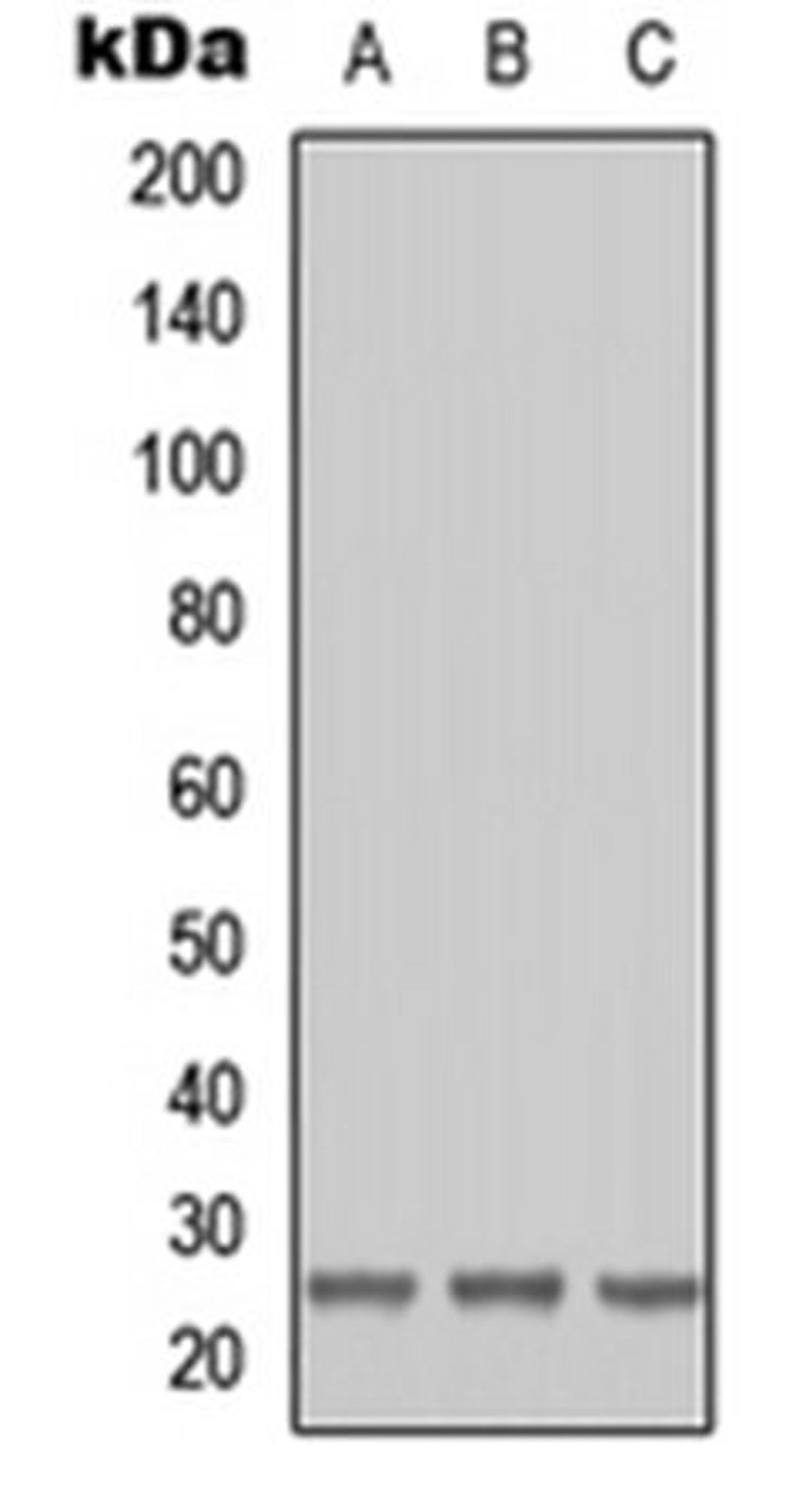 Western blot analysis of HEK293T (Lane 1), Raw264.7 (Lane 2), H9C2 (Lane 3) whole cell lysates using RAB41 antibody