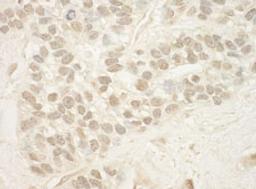 Detection of human MED15 by immunohistochemistry.