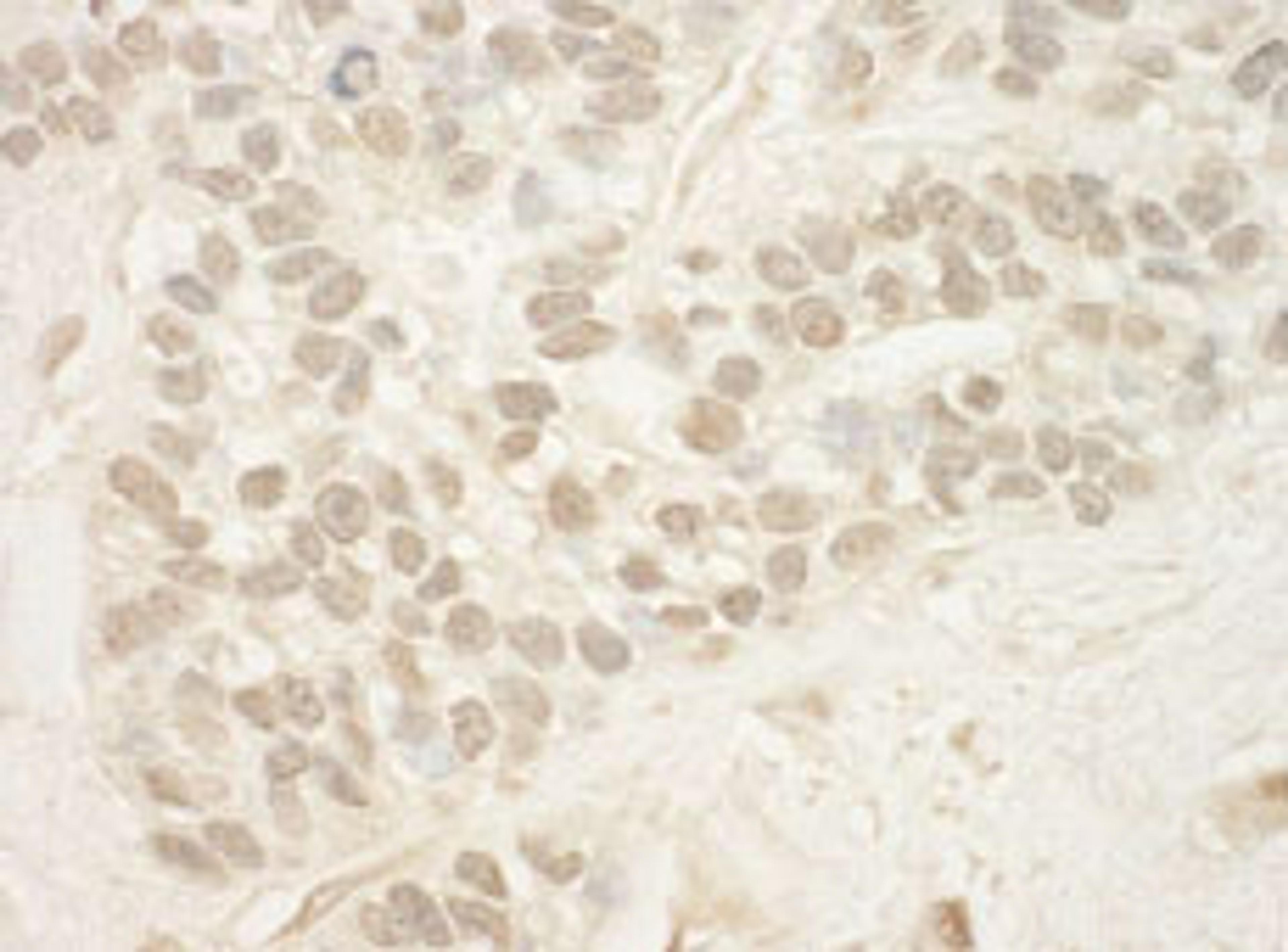 Detection of human MED15 by immunohistochemistry.