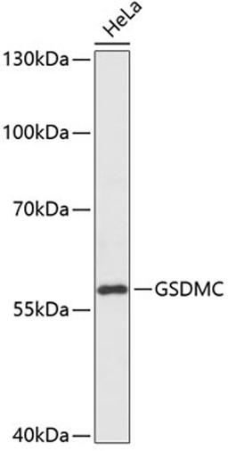 Western blot - GSDMC antibody (A14550)