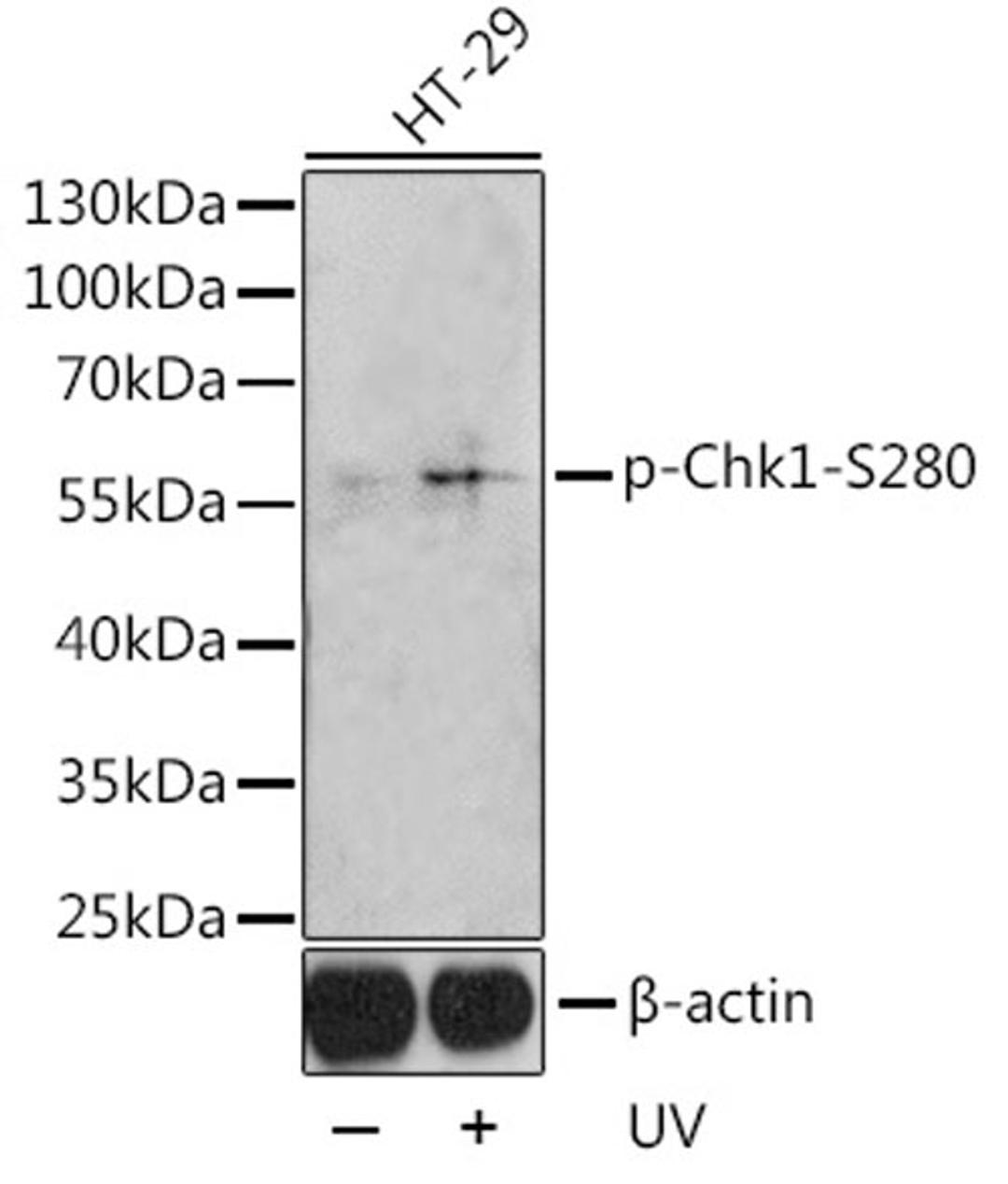 Western blot - Phospho-Chk1-Ser280 antibody (AP0017)