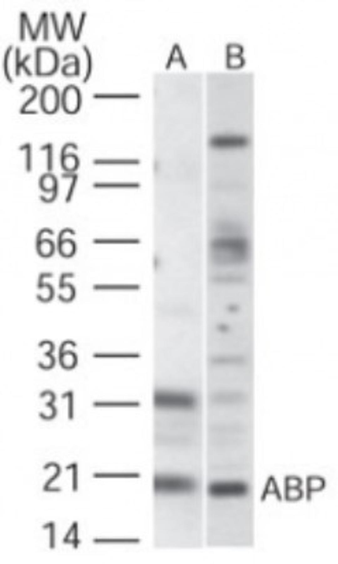 Western Blot: VABP Antibody [NBP2-19020] - Analysis of VABP in (A) human brain and (B) human heart cell lysateusing this antibody at 1 ug/ml.