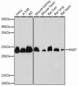 Western blot - RAB7 Rabbit mAb (A12308)