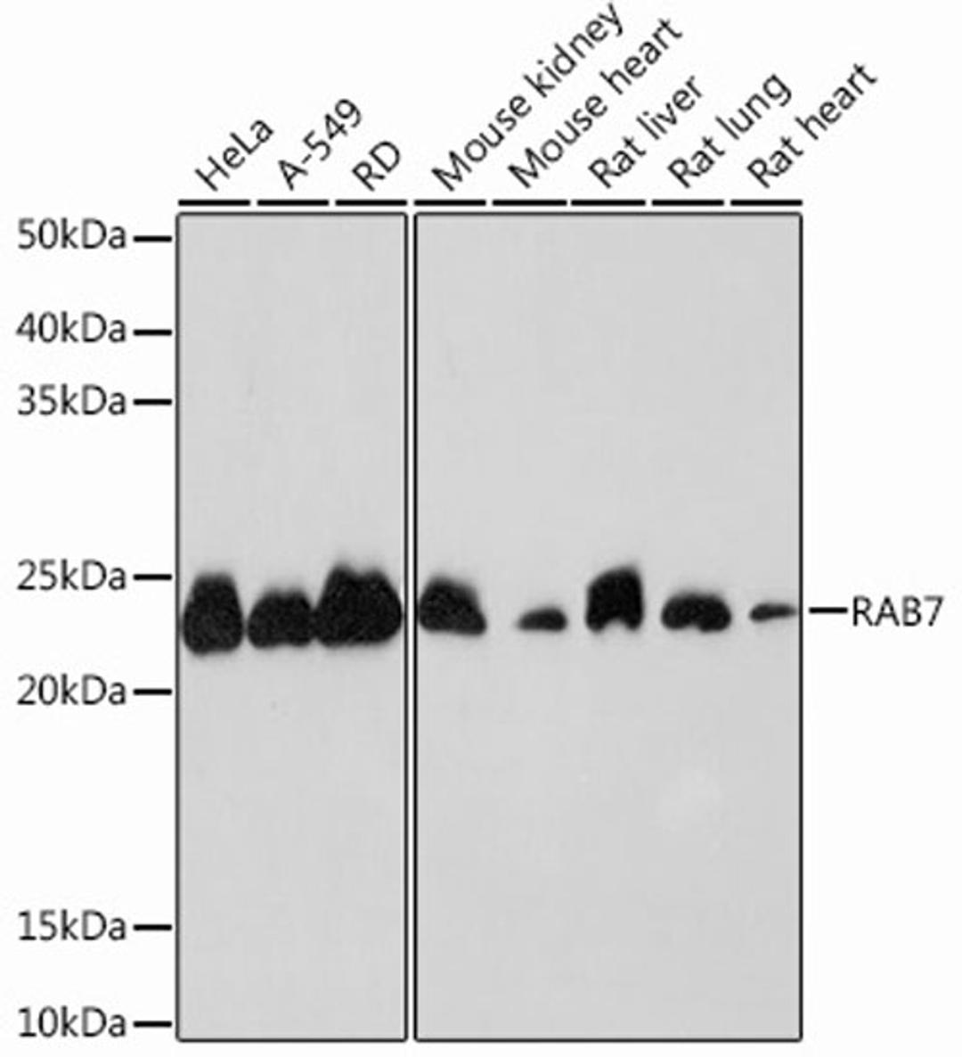 Western blot - RAB7 Rabbit mAb (A12308)