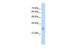 Antibody used in WB on Human Jurkat 1.25 ug/ml.