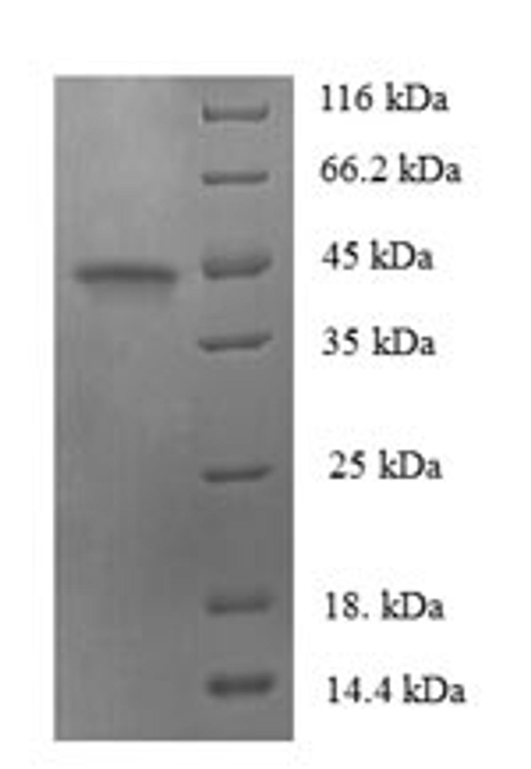 (Tris-Glycine gel) Discontinuous SDS-PAGE (reduced) with 5% enrichment gel and 15% separation gel.