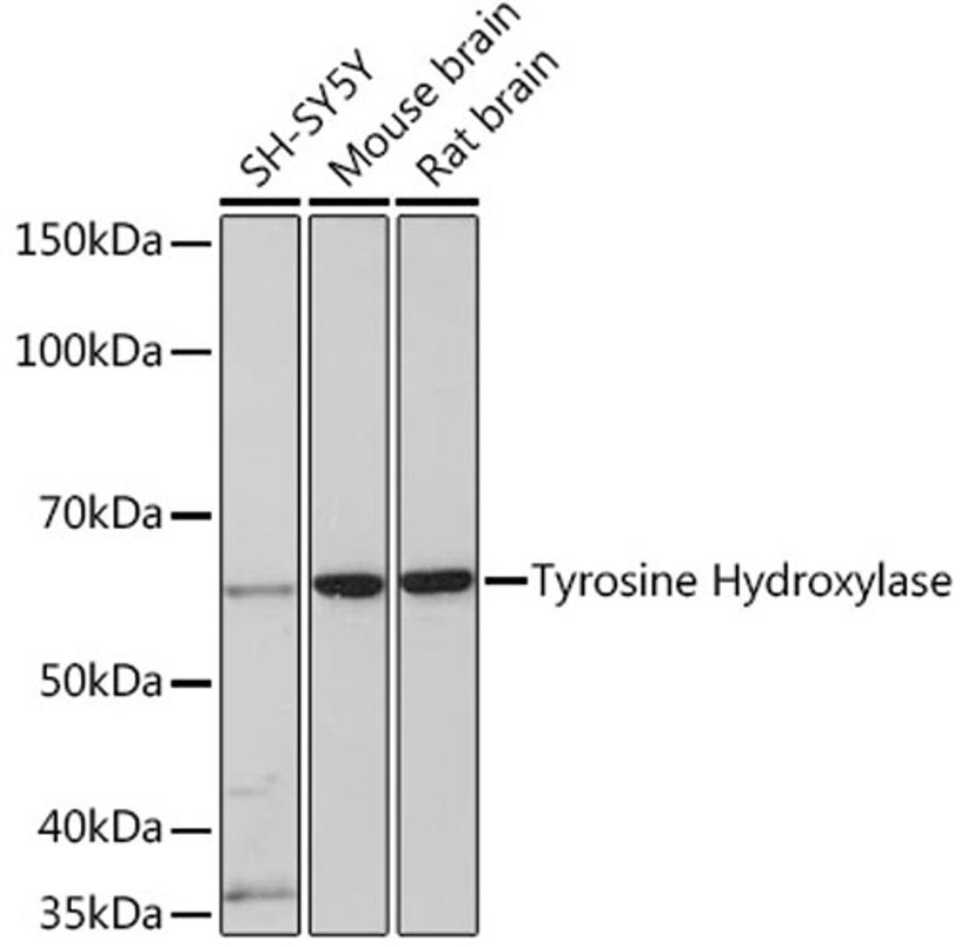 Western blot - Tyrosine Hydroxylase  Rabbit mAb (A5079)