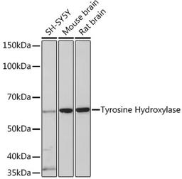 Western blot - Tyrosine Hydroxylase  Rabbit mAb (A5079)