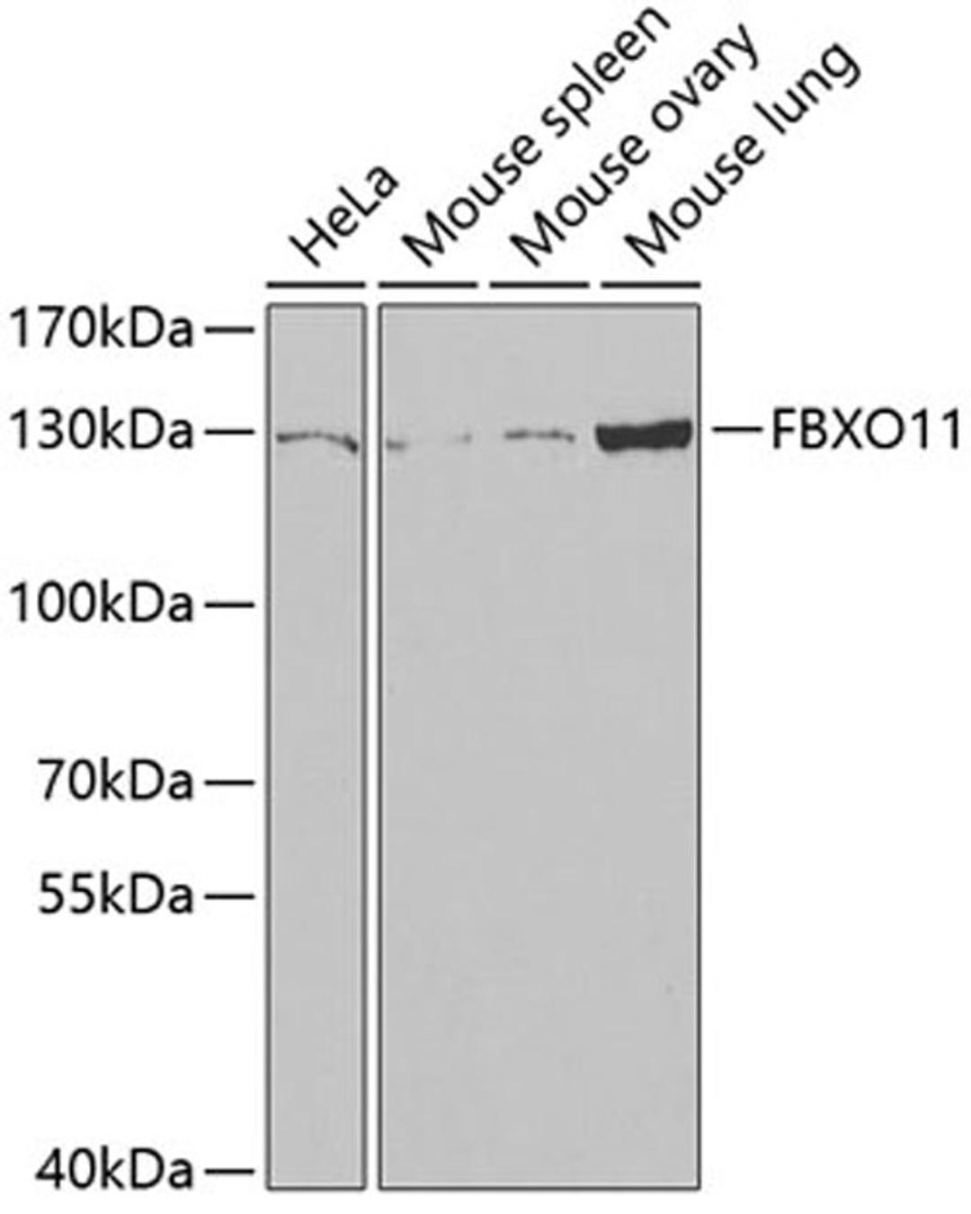 Western blot - FBXO11 antibody (A6153)