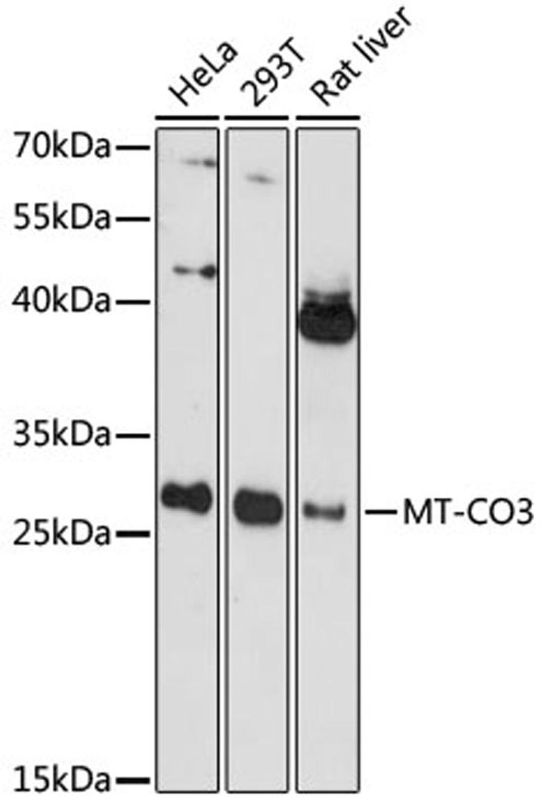 Western blot - MT-CO3 antibody (A17891)