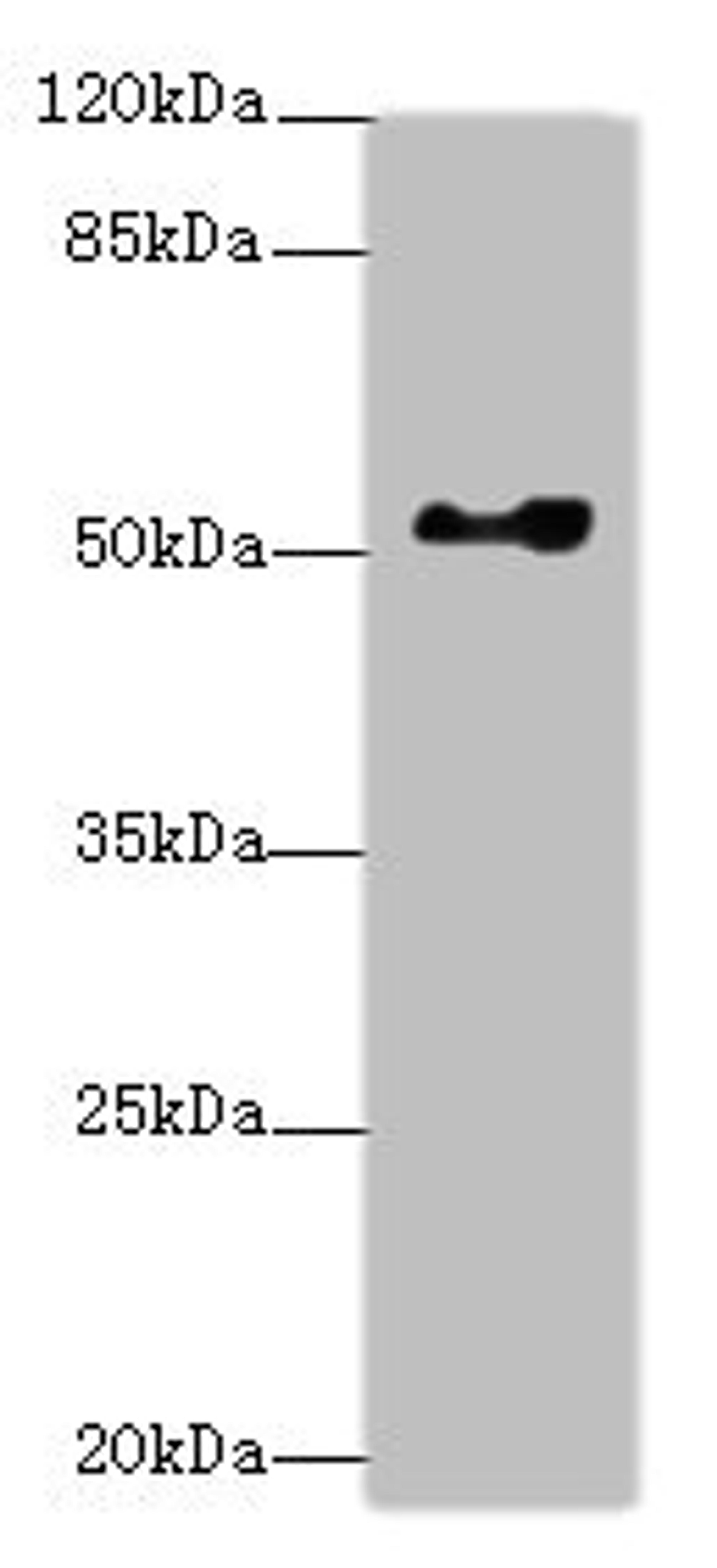 Western blot. All lanes: EIF2S3antibody at 0.83ug/ml + Hela whole cell lysate. Secondary. Goat polyclonal to rabbit IgG at 1/10000 dilution. Predicted band size: 51 kDa. Observed band size: 51 kDa. 