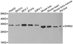 Western blot analysis of extracts of various cell lines using DHRS2 antibody