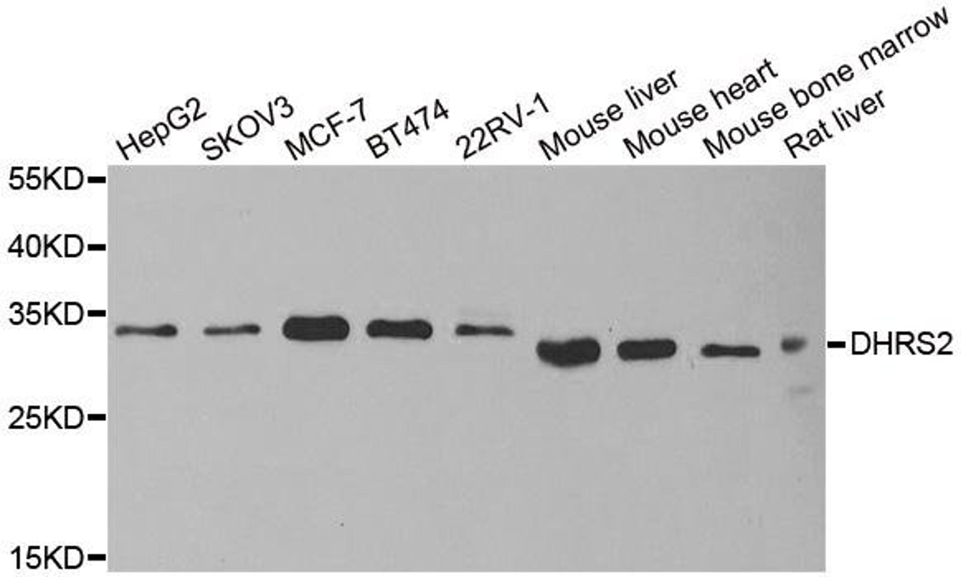 Western blot analysis of extracts of various cell lines using DHRS2 antibody