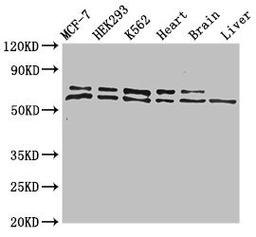 Western Blot. Positive WB detected in: MCF-7 whole cell lysate, HEK293 whole cell lysate, K562 whole cell lysate, Mouse heart tissue, Mouse brain tissue, Mouse liver tissue. All lanes: ACAD9 antibody at 1ug/ml. Secondary. Goat polyclonal to rabbit IgG at 1/50000 dilution. Predicted band size: 69 kDa. Observed band size: 69, 70 kDa.