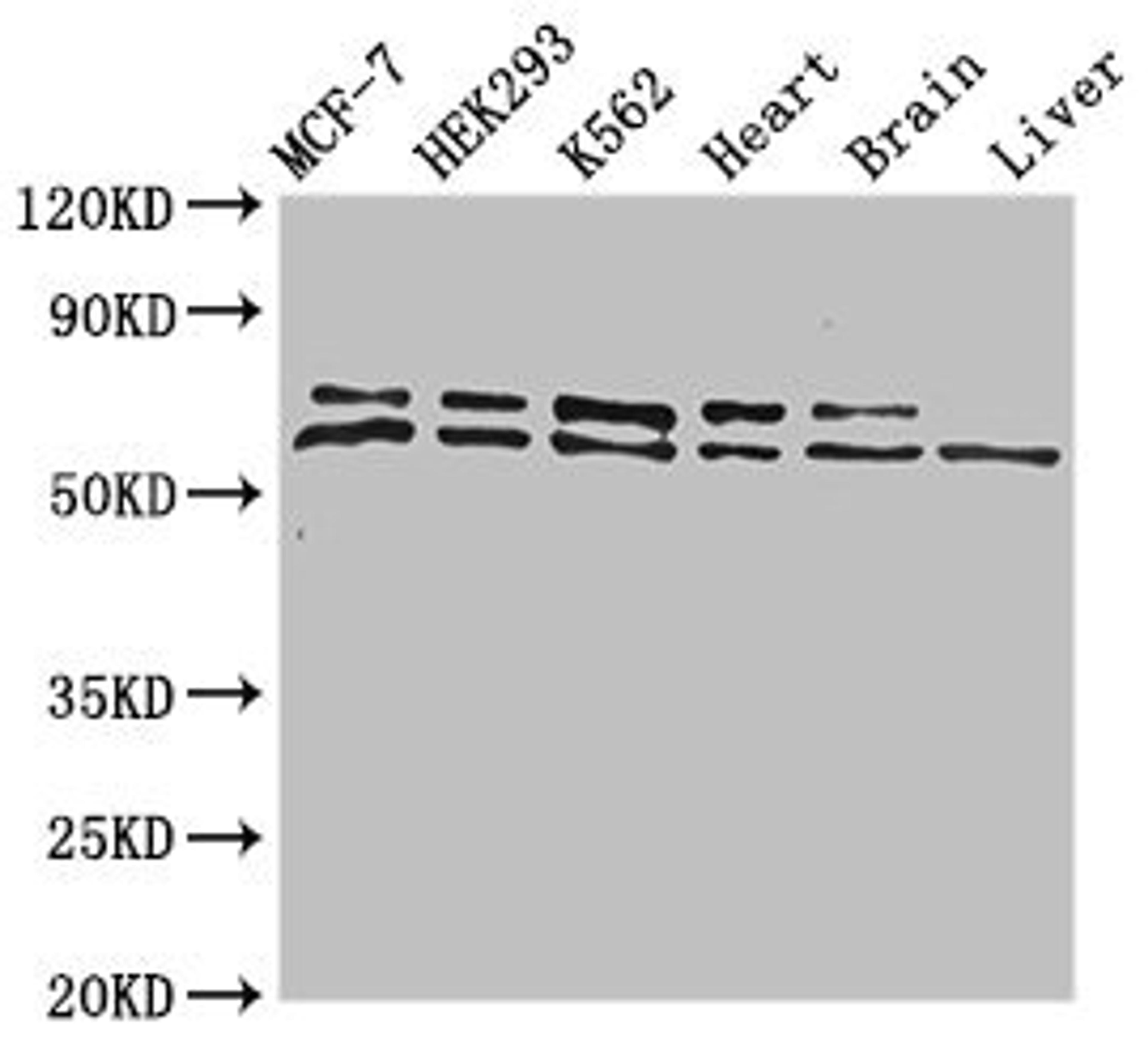 Western Blot. Positive WB detected in: MCF-7 whole cell lysate, HEK293 whole cell lysate, K562 whole cell lysate, Mouse heart tissue, Mouse brain tissue, Mouse liver tissue. All lanes: ACAD9 antibody at 1ug/ml. Secondary. Goat polyclonal to rabbit IgG at 1/50000 dilution. Predicted band size: 69 kDa. Observed band size: 69, 70 kDa.