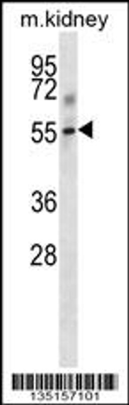 Western blot analysis in mouse kidney tissue lysates (35ug/lane).