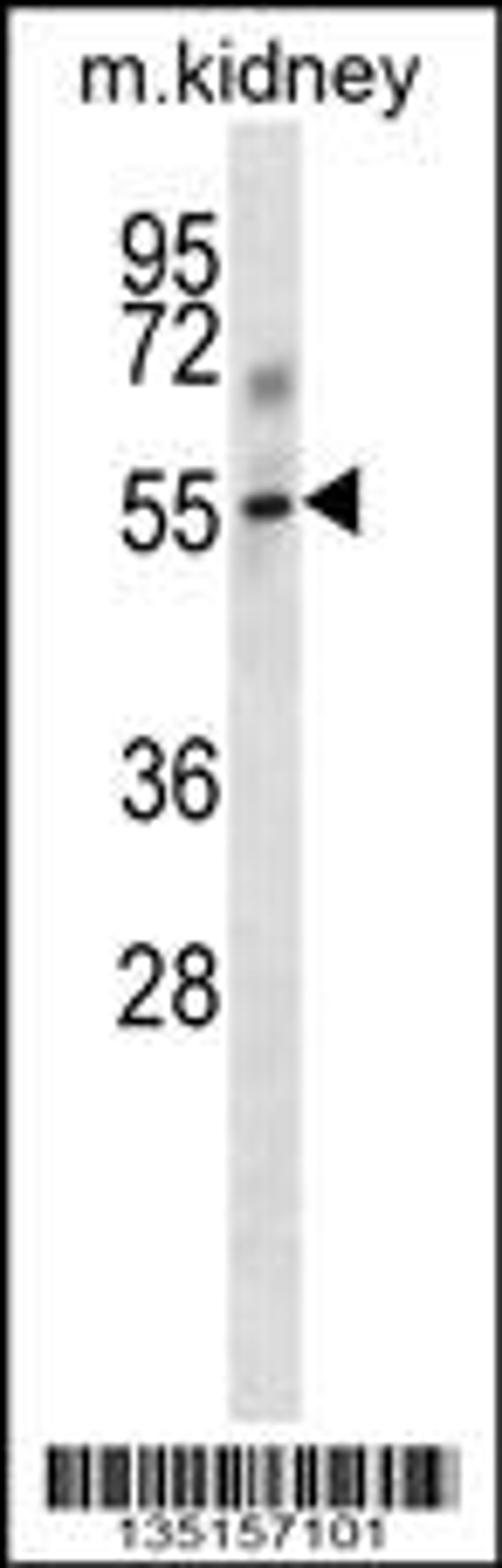 Western blot analysis in mouse kidney tissue lysates (35ug/lane).