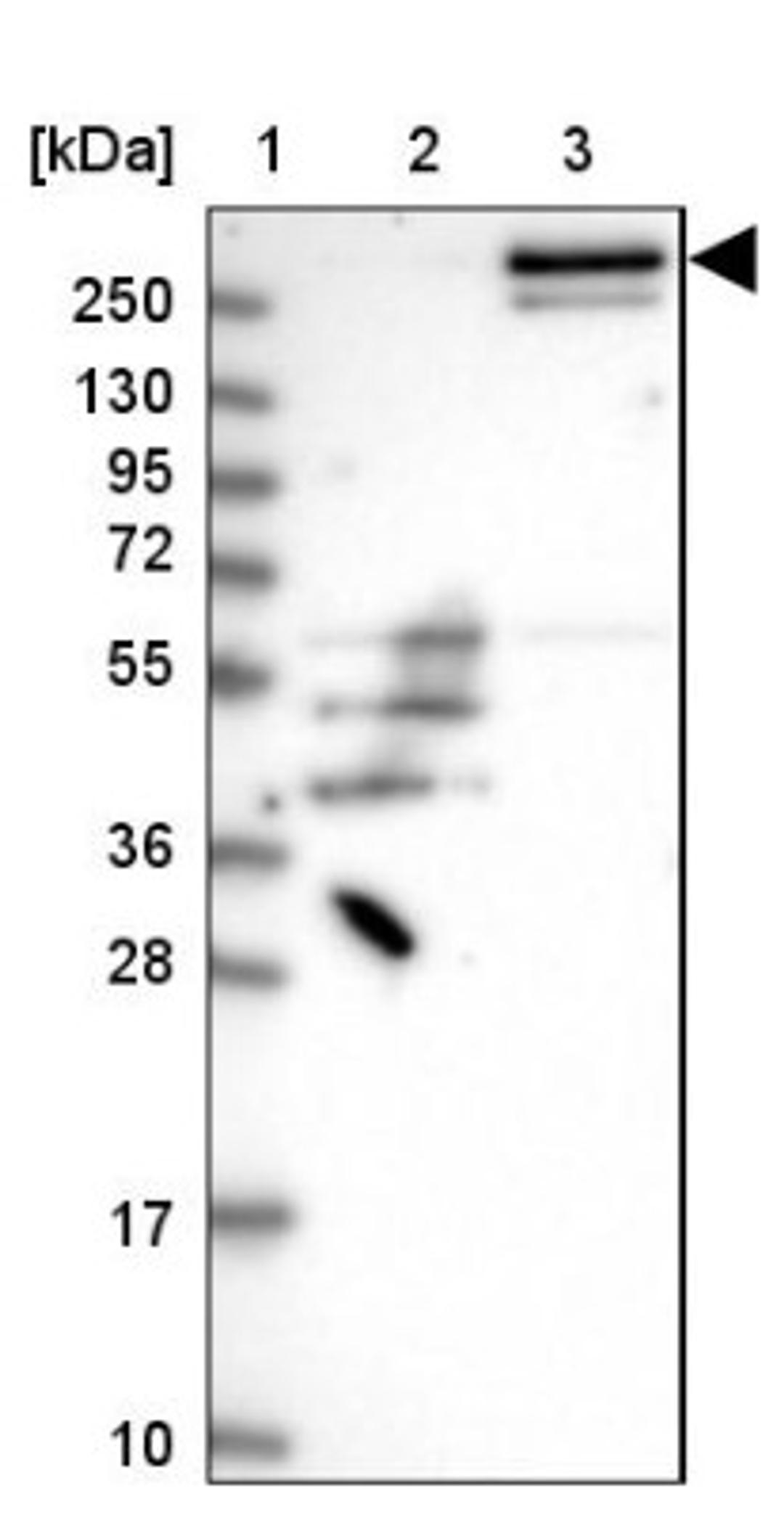 Western Blot: FAM186A Antibody [NBP1-93553] - Lane 1: Marker [kDa] 250, 130, 95, 72, 55, 36, 28, 17, 10<br/>Lane 2: Human cell line RT-4<br/>Lane 3: Human cell line U-251MG sp