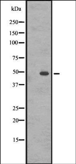 Western blot analysis of A431 whole cell lysate using GASR antibody