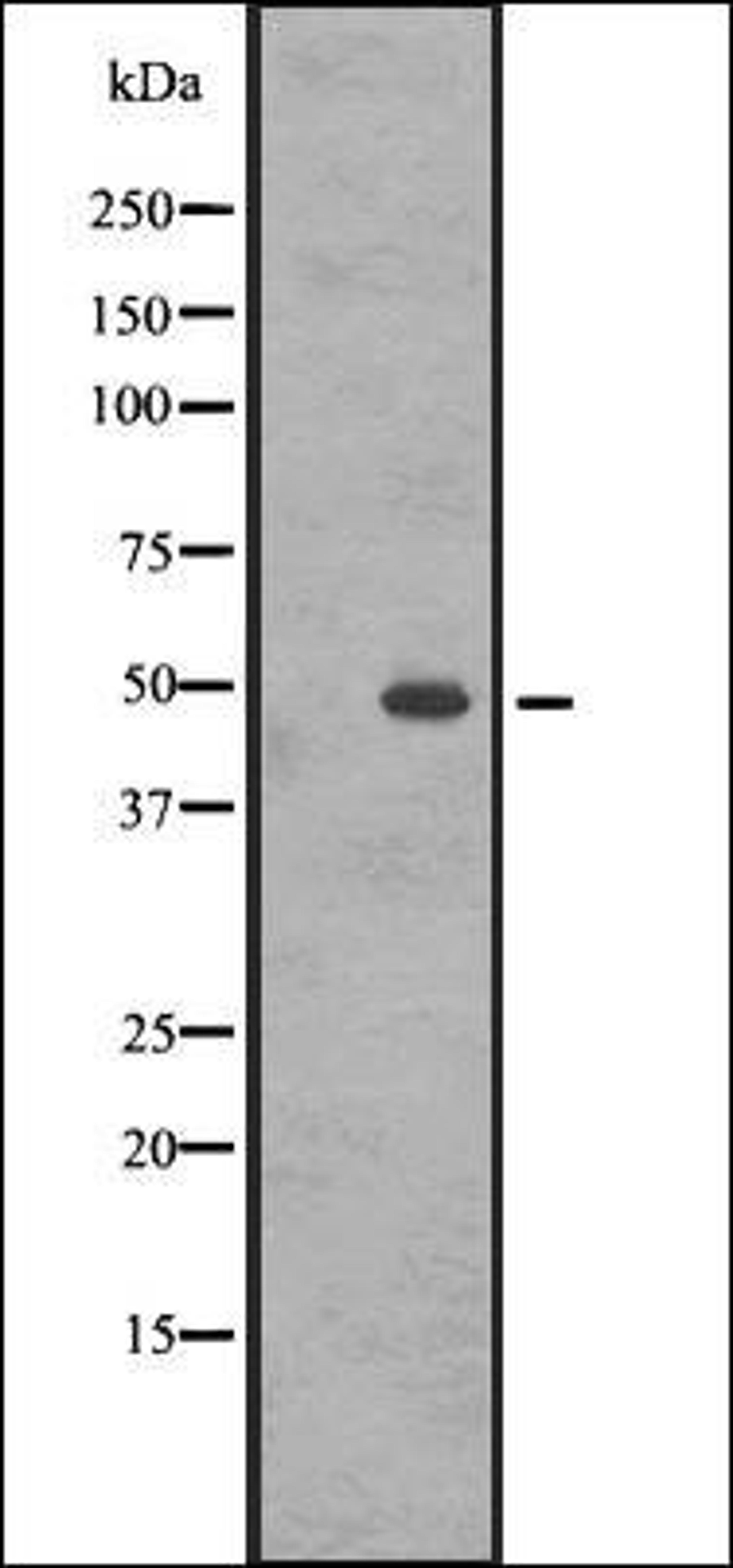 Western blot analysis of A431 whole cell lysate using GASR antibody