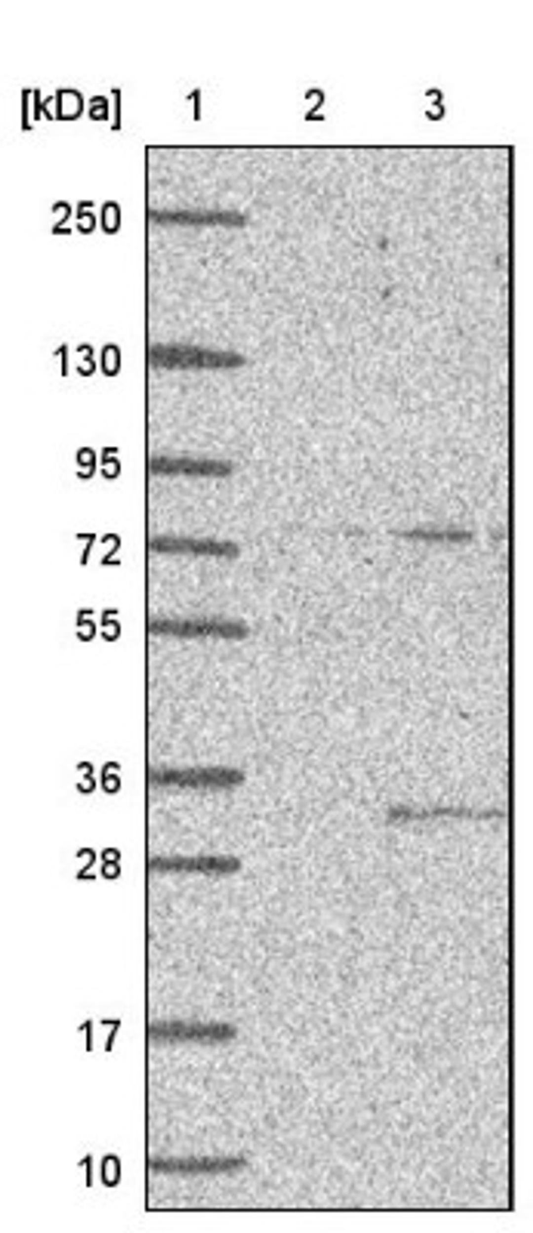 Western Blot: CIB2 Antibody [NBP1-81351] - Lane 1: Marker [kDa] 250, 130, 95, 72, 55, 36, 28, 17, 10<br/>Lane 2: Negative control (vector only transfected HEK293T lysate)<br/>Lane 3: Over-expression lysate (Co-expressed with a C-terminal myc-DDK tag (~3.1 kDa) in mammalian HEK293T cells, LY416682)