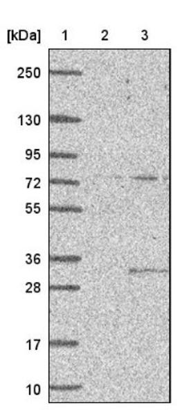 Western Blot: CIB2 Antibody [NBP1-81351] - Lane 1: Marker [kDa] 250, 130, 95, 72, 55, 36, 28, 17, 10<br/>Lane 2: Negative control (vector only transfected HEK293T lysate)<br/>Lane 3: Over-expression lysate (Co-expressed with a C-terminal myc-DDK tag (~3.1 kDa) in mammalian HEK293T cells, LY416682)