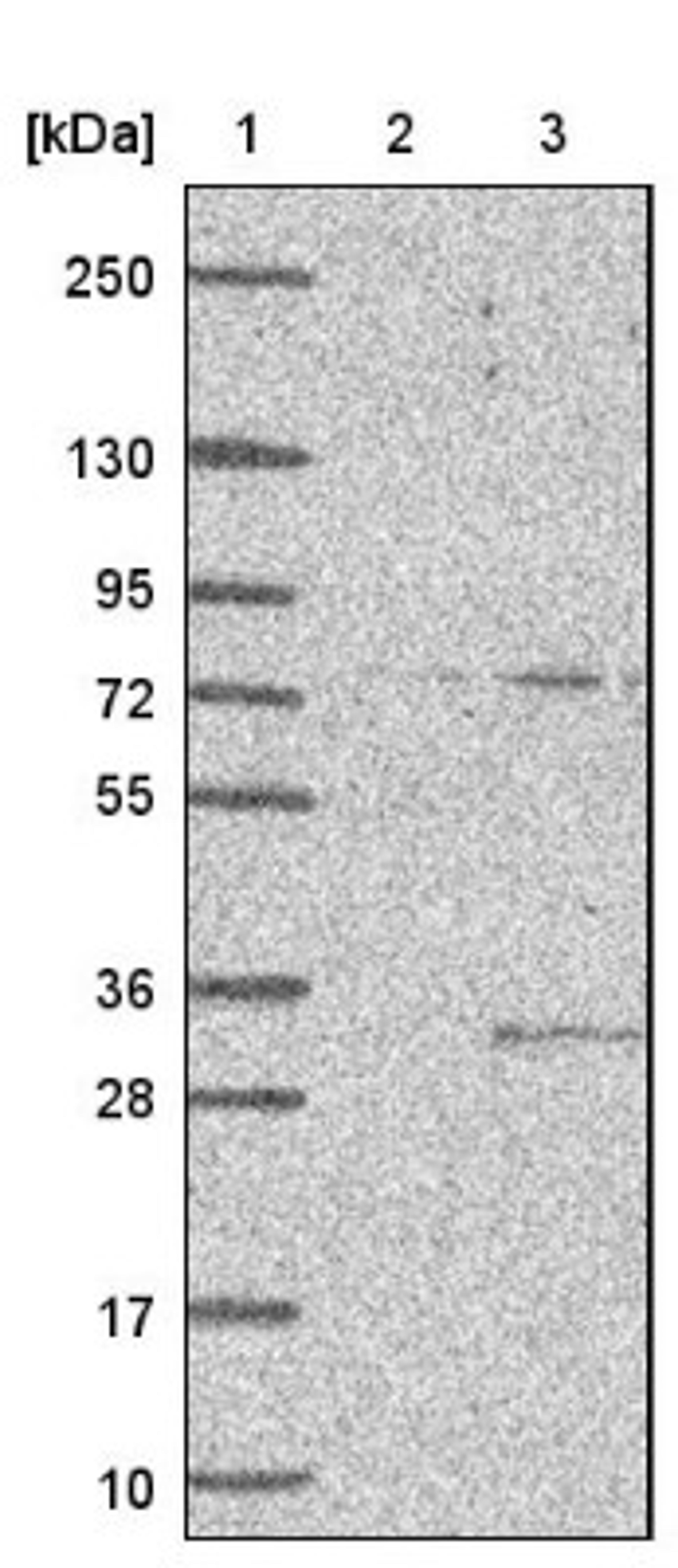 Western Blot: CIB2 Antibody [NBP1-81351] - Lane 1: Marker [kDa] 250, 130, 95, 72, 55, 36, 28, 17, 10<br/>Lane 2: Negative control (vector only transfected HEK293T lysate)<br/>Lane 3: Over-expression lysate (Co-expressed with a C-terminal myc-DDK tag (~3.1 kDa) in mammalian HEK293T cells, LY416682)